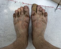 After walking one day. Pasturat. France. After walking one day. Pasturat. France.