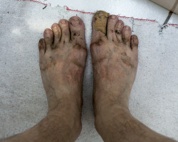 After walking one day. After walking one day.